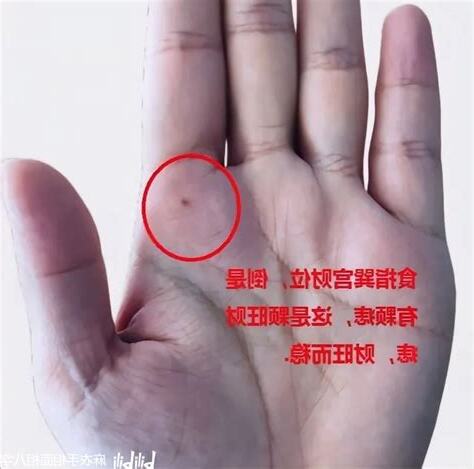 右手食指 痣